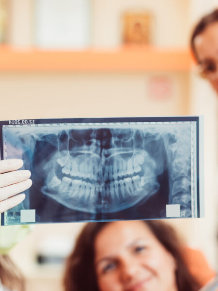 shutterstock_300017999 dental x-rays